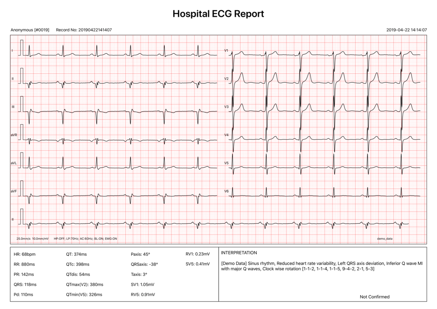 ECG para iPad iCV200BLE