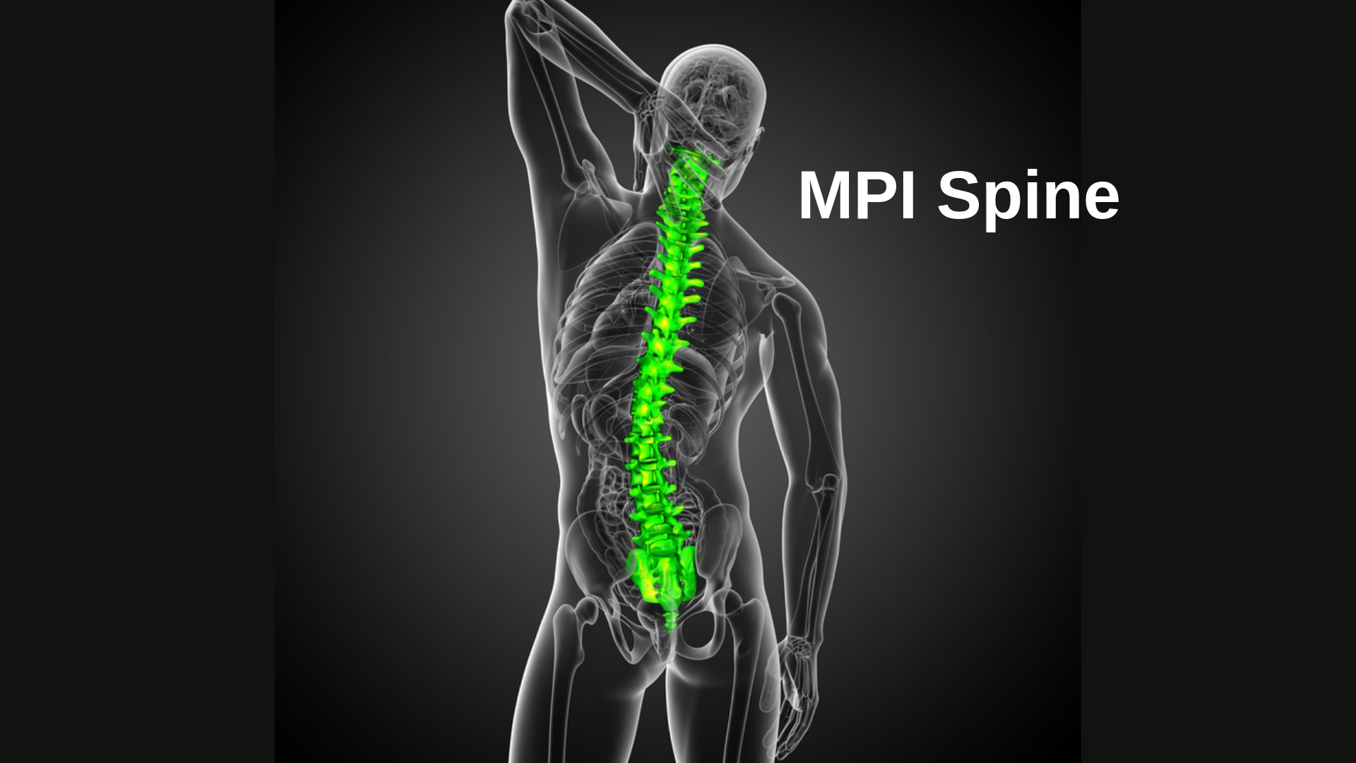 MPI Spine