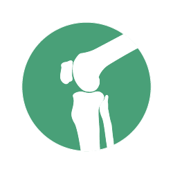 Informations pour le patient arthrose du genou
