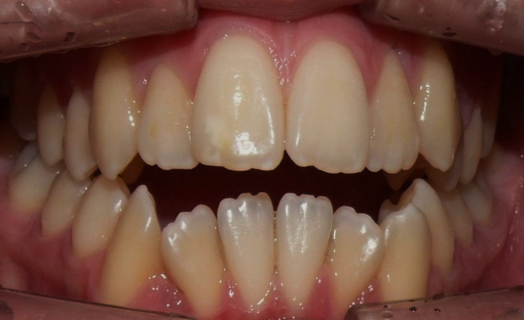 Placeholder Image