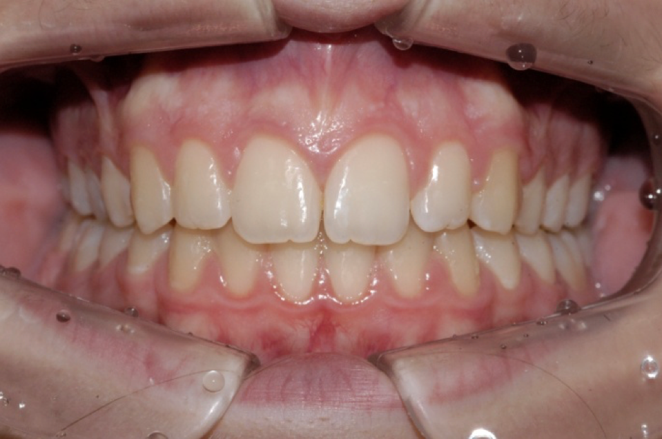 Placeholder Image