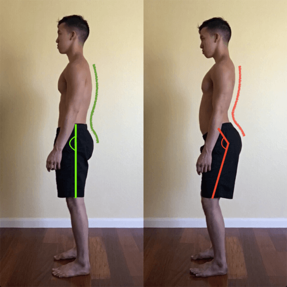 person with back pain