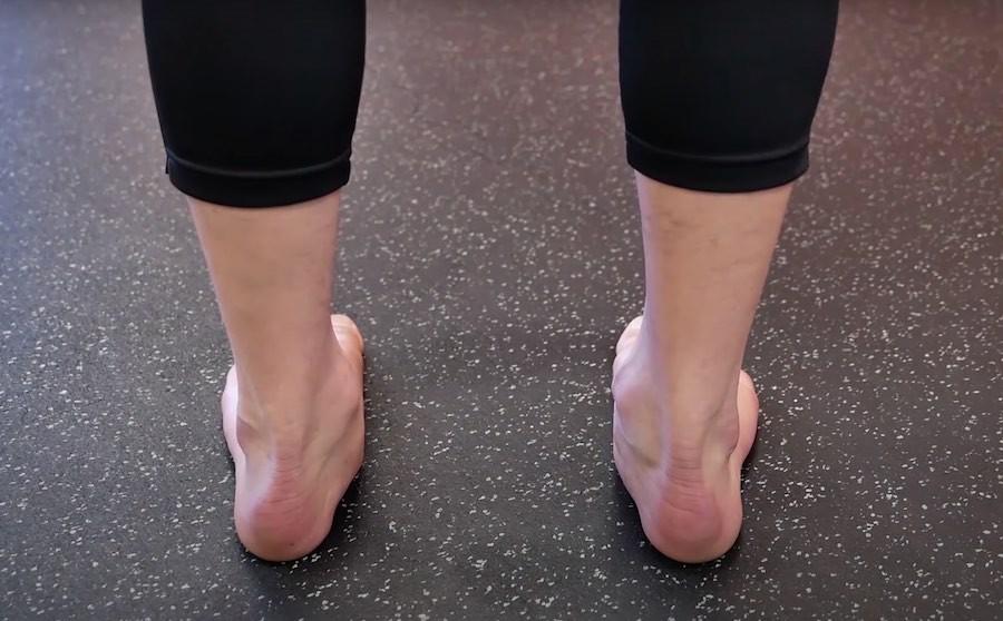 flat feet and collapsed ankles and foot pain