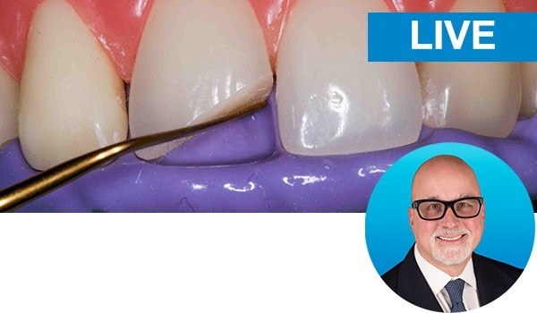 Restoring the Discolored Central Incisor with Dr. Bob Margeas: live hands-on course