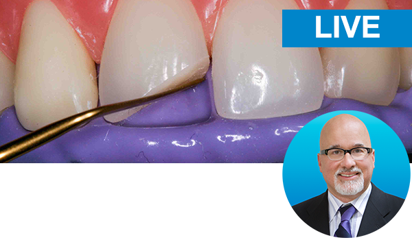 Restoring the Discolored Central Incisor with Dr. Bob Margeas: live hands-on course