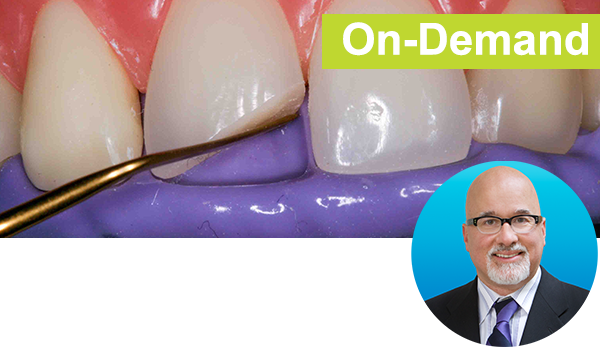 Freehand Diastema Closure Instructor: Dr. Bob Margeas The on-demand, step-by-step hands-on course focuses on Dr. Margeas’s simplified technique that quickly establishes ideal width, proximal contact and contour without removing any tooth structure. Learn polishing and surface texturing that will produce natural-looking long term restorations. 2 HOURS | 2 CE CREDITS BM102