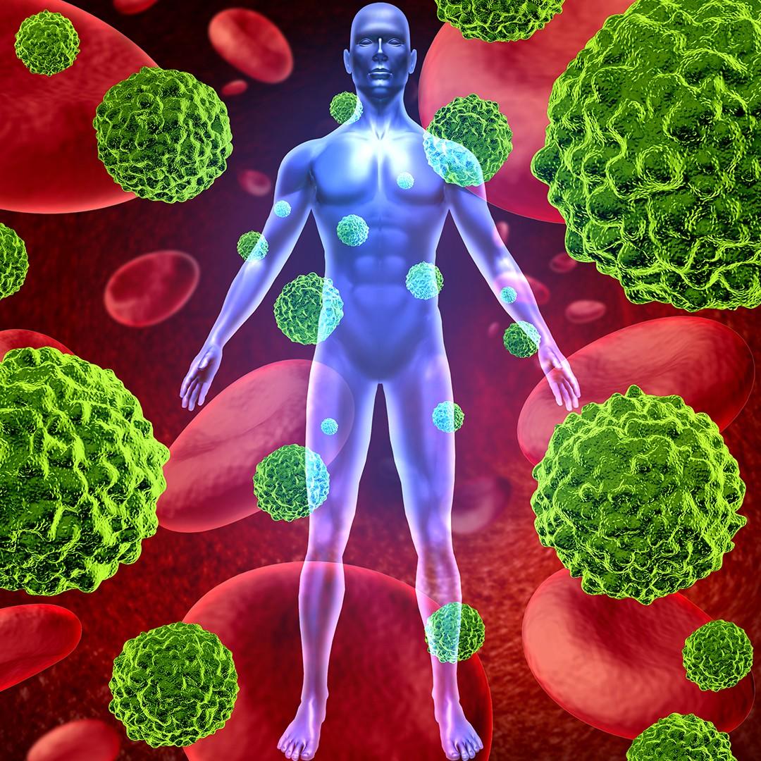 Digital Rendering of Human Body surrounded by cancer cells - Natural Cancer Care Therapy Goals - pureBalance Wellness Cancer Care Mississauga
