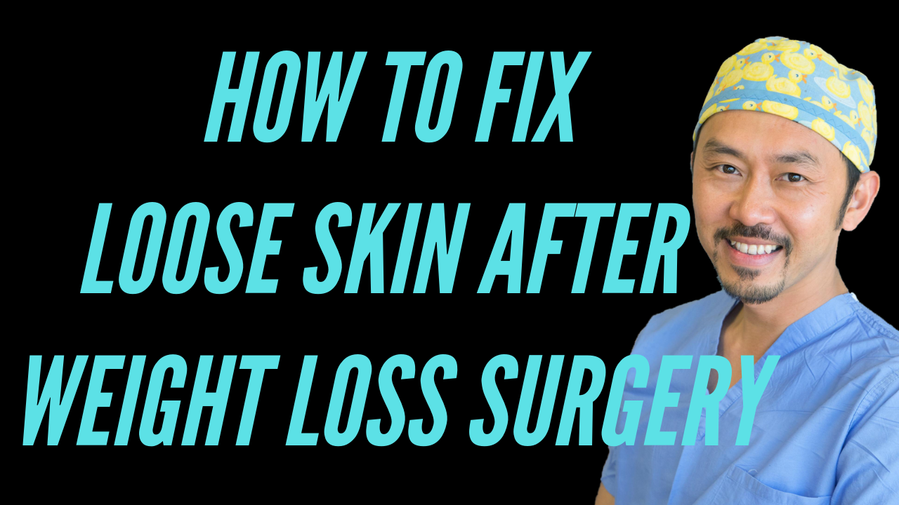How To Help Loose Skin After Weight Loss Surgery A Dr V Video