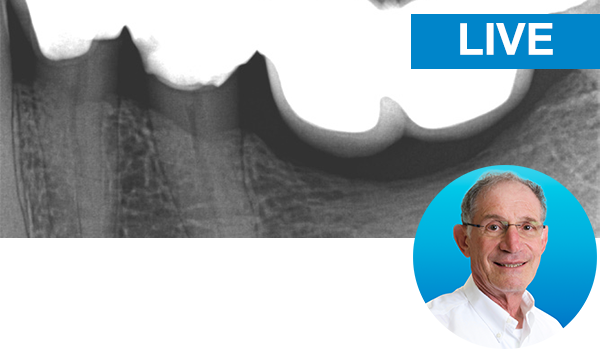 Bulk fill posterior resin composite restorations made easy with Dr. Vargas